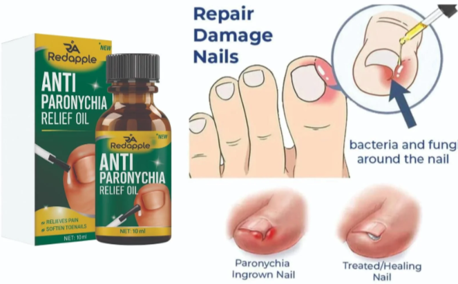 Anti Paronychia Relief Oil Buy 1 Get 1 Free