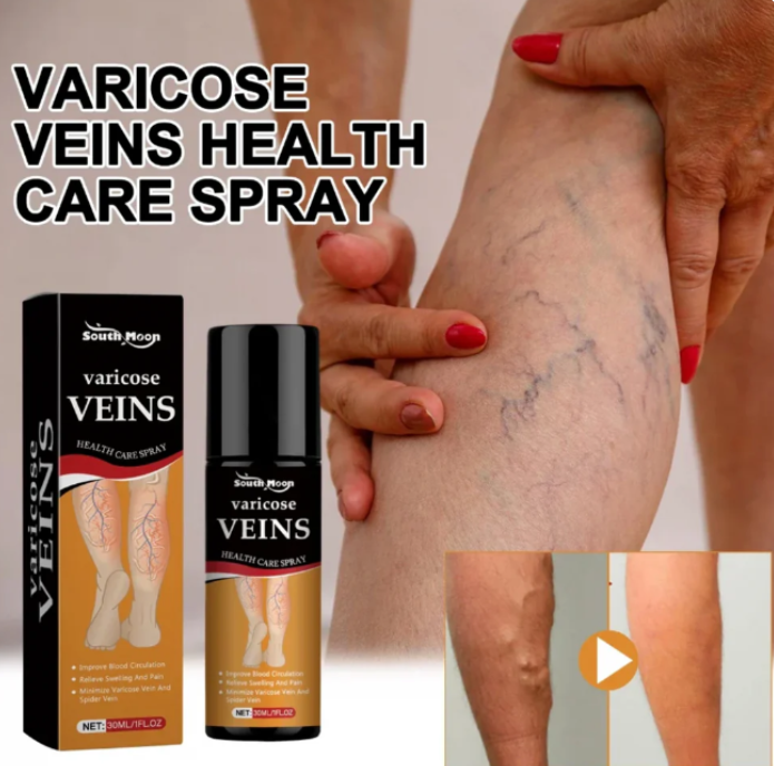Turmeric Varicose Vein Relief Spray (BUY 1 GET 2 FREE š)